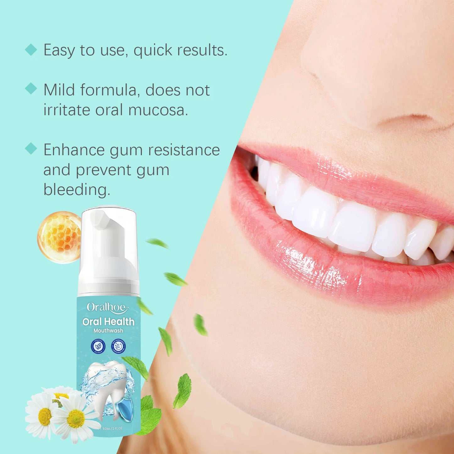 OralHoe Teeth Cleaning Mousse – Whitens, Fresh Breath, Removes Yellow Stains