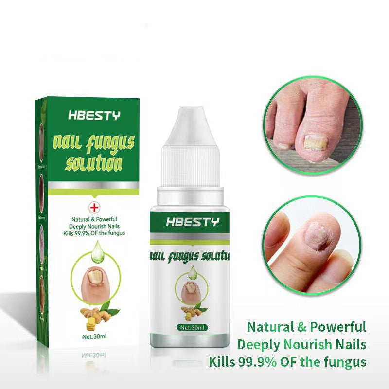 Nail Fungal Treatment
